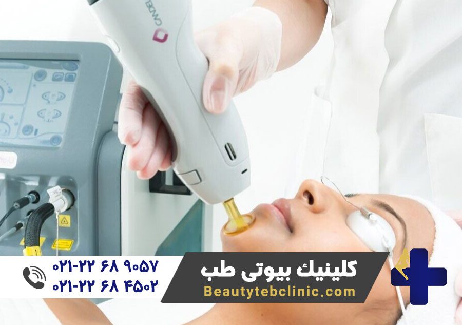 دستگاه لیزر پوست | لیزر پوست | لیزر موهای زائد | لیزر دایود | لیزر الکساندرایت | رفع موهای زائد | پزشک متخصص لیزر 