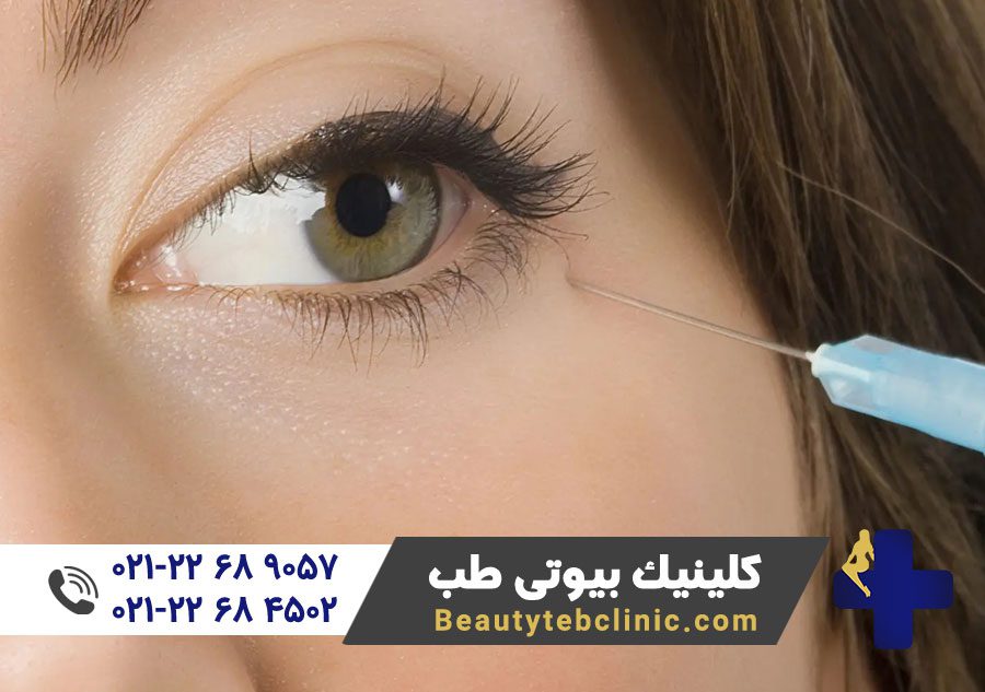 تزریق بوتاکس | تزریق بوتاکس صورت | تزریق بوتاکس چشم | تزریق بوتاکس پیشانی | هزینه بوتاکس | پزشک متخصص زیبایی
