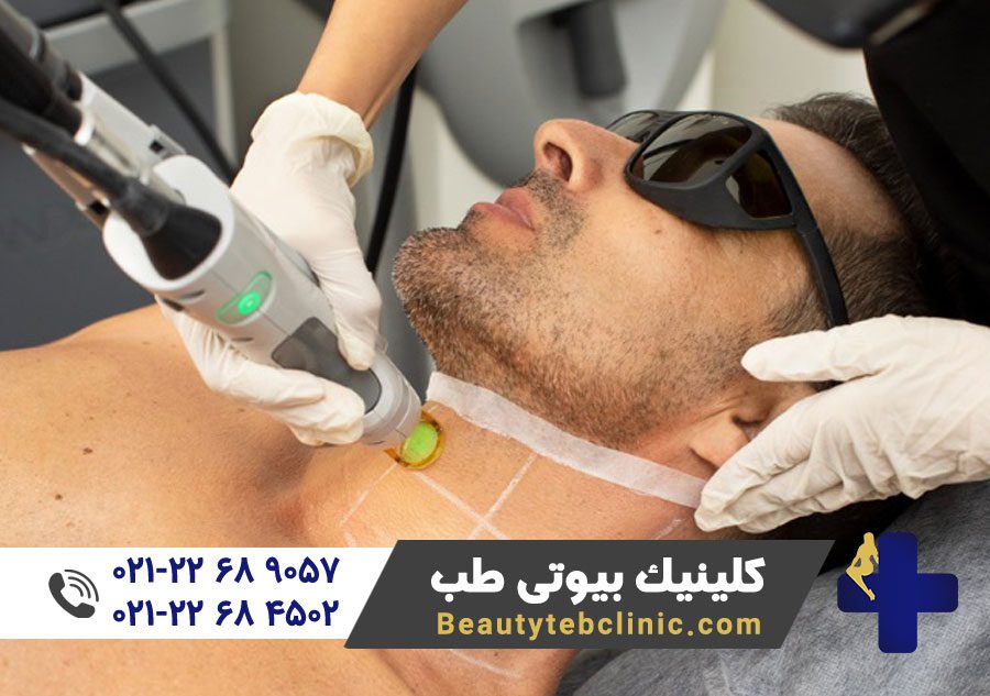 laser clinics candela a tailored laser hair removal for you